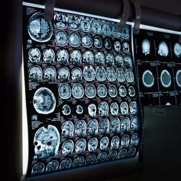 Le Groupe de radiologie 3R sous le choc d'une nouvelle cyberattaque d’envergure